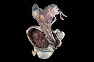 My little fetal pony wins top Wellcome photo prize