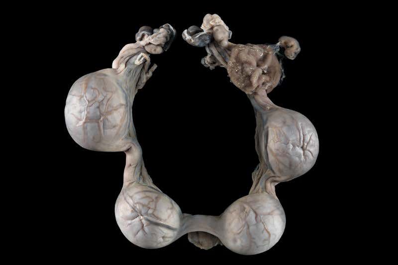 My little fetal pony wins top Wellcome photo prize