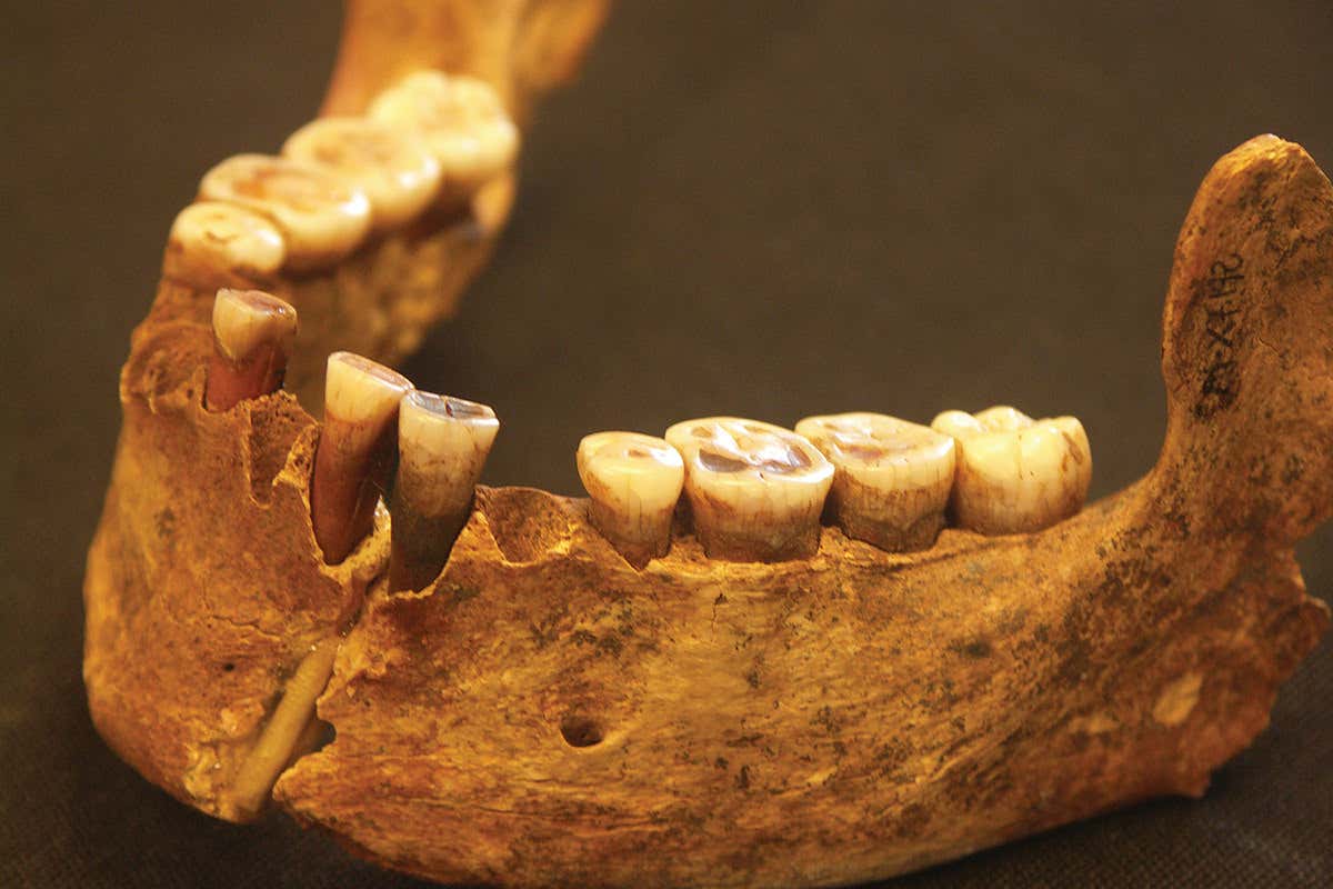 Most of her own teeth too 