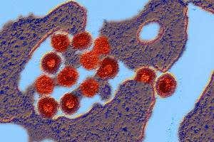 Virus hiding in our genome protects early human embryos