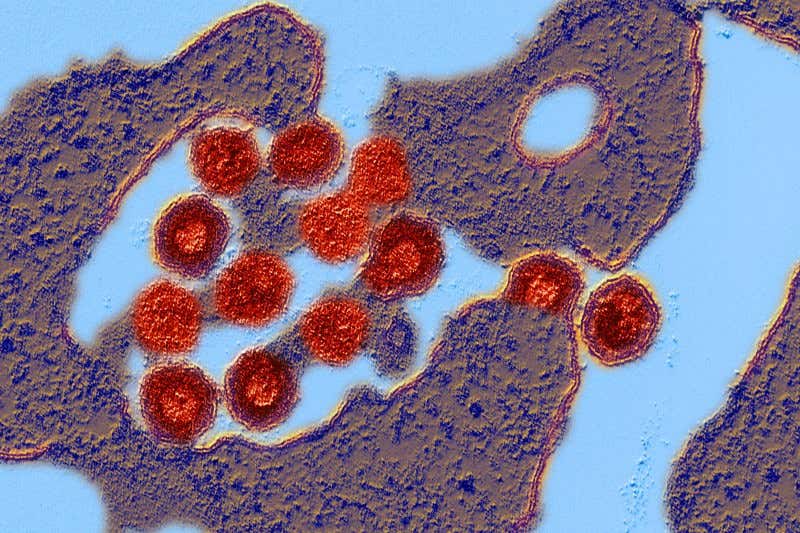 New Scientist. Science news and long reads from expert journalists, covering developments in science, technology, health and the environment on the website and the magazine.