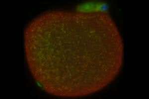 Gene editing could prevent mitochondrial disease in children