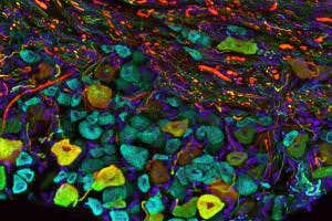 Bats use unusual touch sensors to catch a mid-air meal