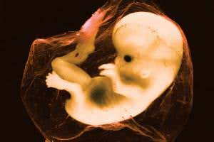 Womb milk nourishes human embryo during first weeks of pregnancy