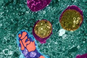 Brain-eating amoebas kill by turning your body against you