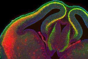 Rewiring of senses in a mouse brain revealed in glorious colour