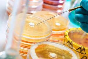 Vital antibiotics research needs radical new incentives