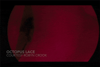 Octopus has automatic camouflage thanks to its light-sensing skin