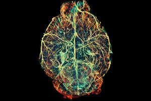 20 billion nanoparticles talk to the brain using electricity