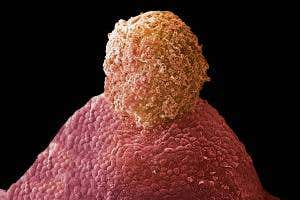 All you need to know about conceiving babies from thawed ovaries