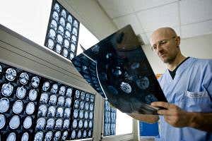 Surgeon proposes human head transplant operation as soon as 2017