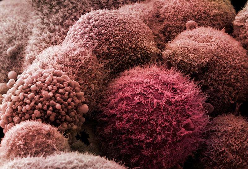 New Scientist. Science news and long reads from expert journalists, covering developments in science, technology, health and the environment on the website and the magazine.