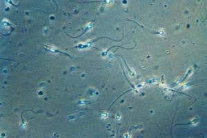 Weird cells in your semen? Don't panic, you might just have flu