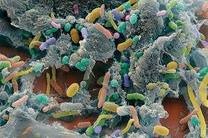 Unregulated faecal transplants could squander gut-bug promise