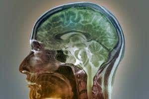 Blocking brain protein could stop memory loss caused by ageing