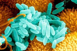 Resistant bacteria don't just evade drugs – they are fitter too