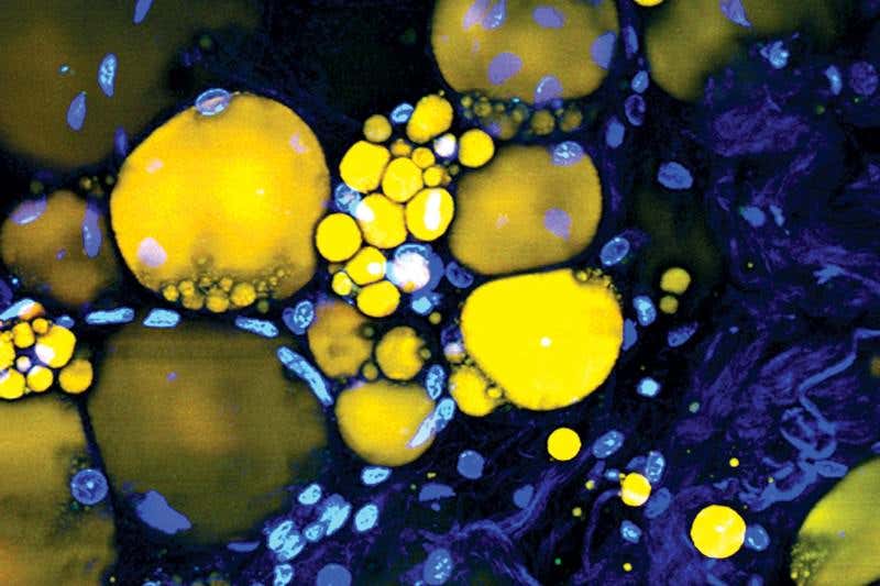 Living lasers made by injecting oil droplets into human cells