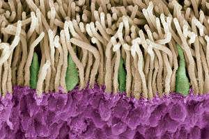 Gene therapy cures blindness by replacing vision cells in eyes