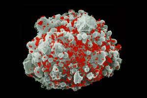 HIV may kill most cells by a method overlooked for years