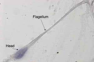 Patent for first method to create human sperm, but does it work?
