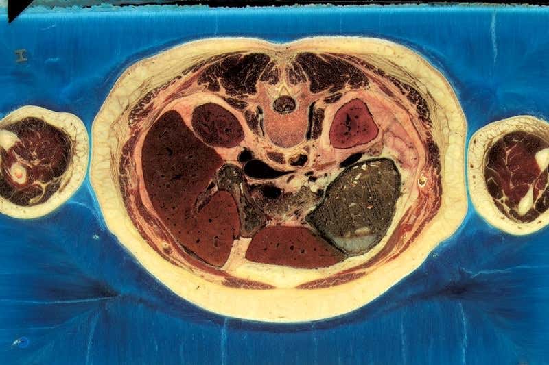 New Scientist. Science news and long reads from expert journalists, covering developments in science, technology, health and the environment on the website and the magazine.