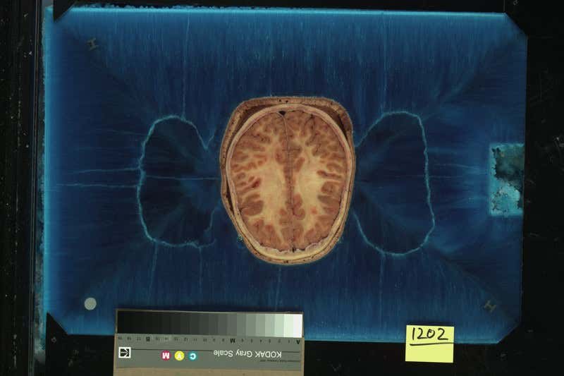 New Scientist. Science news and long reads from expert journalists, covering developments in science, technology, health and the environment on the website and the magazine.