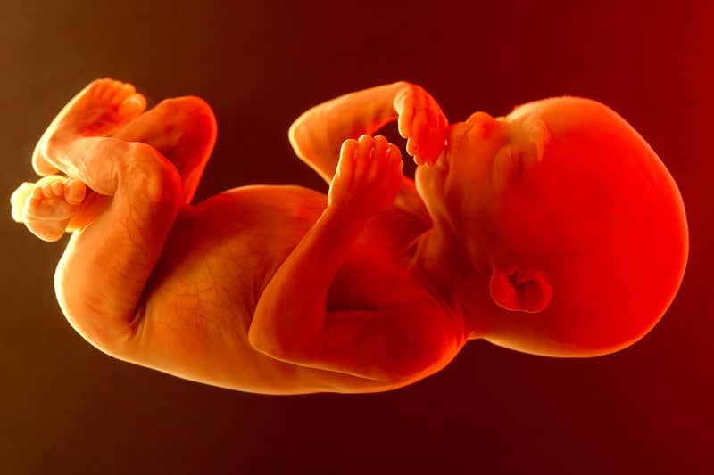 World's first trial of stem cell therapy in the womb