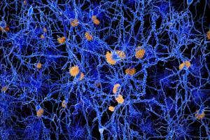 Alzheimer's drug found to cause harm to mouse brain cells
