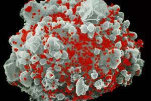 Anti-booze drug may flush out dormant HIV and could lead to cure