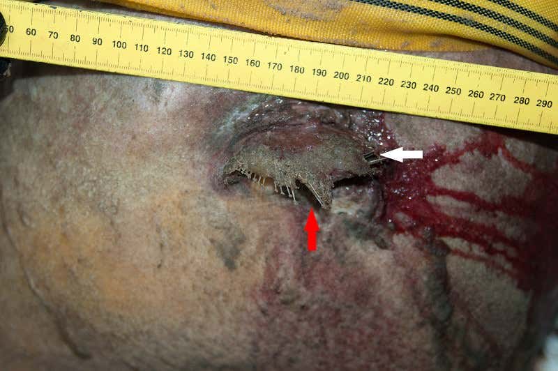 New Scientist. Science news and long reads from expert journalists, covering developments in science, technology, health and the environment on the website and the magazine.