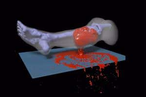 Blood gushes from virtual leg injury to help train combat medics