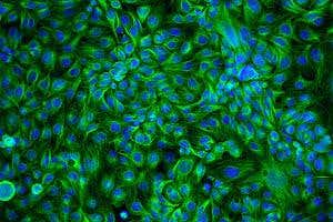 Cancer's genetic tipping point reveals who'd benefit from chemo