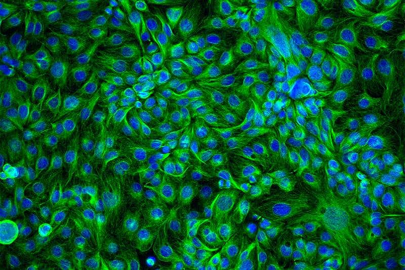 New Scientist. Science news and long reads from expert journalists, covering developments in science, technology, health and the environment on the website and the magazine.