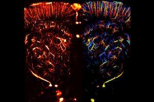 First images of live blood vessels in unprecedented clarity