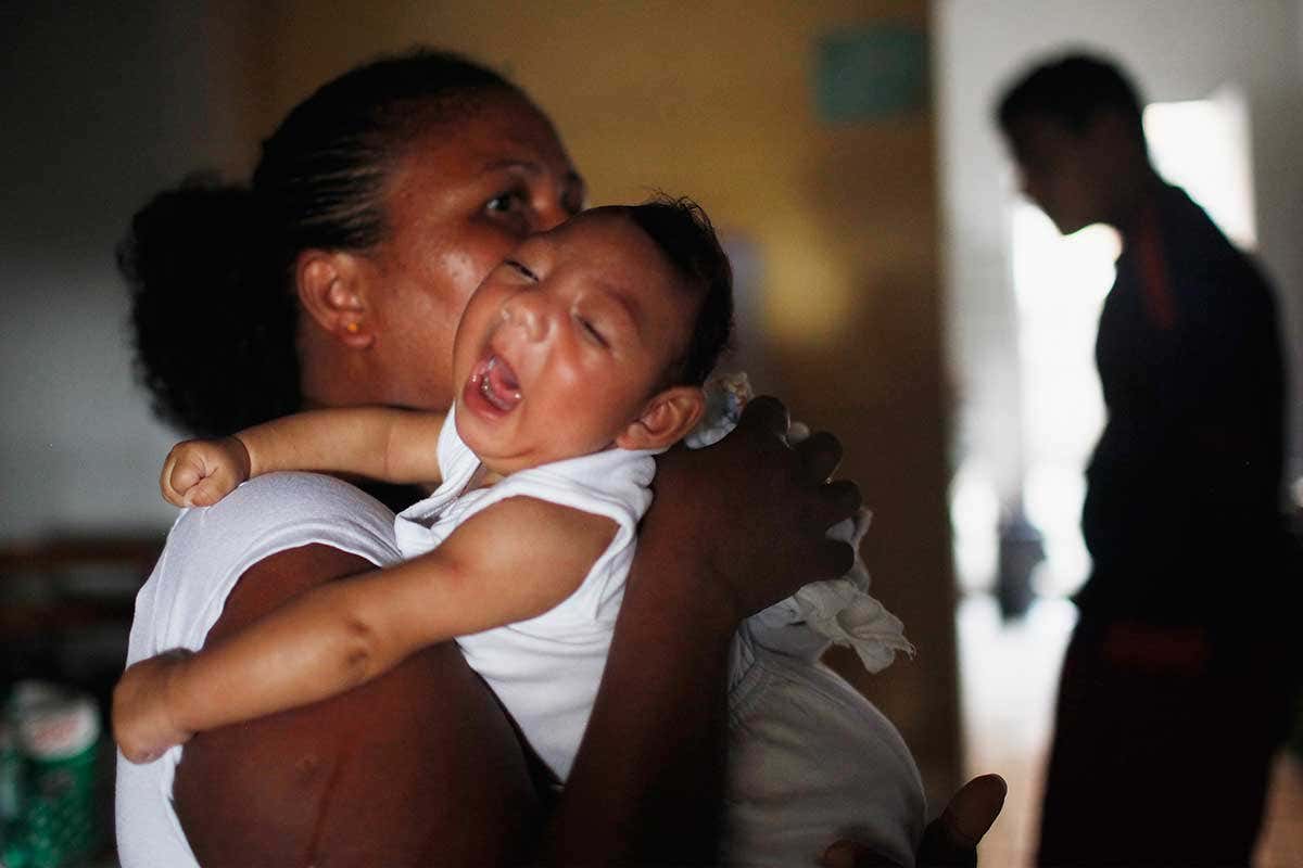 Baby with microcephaly