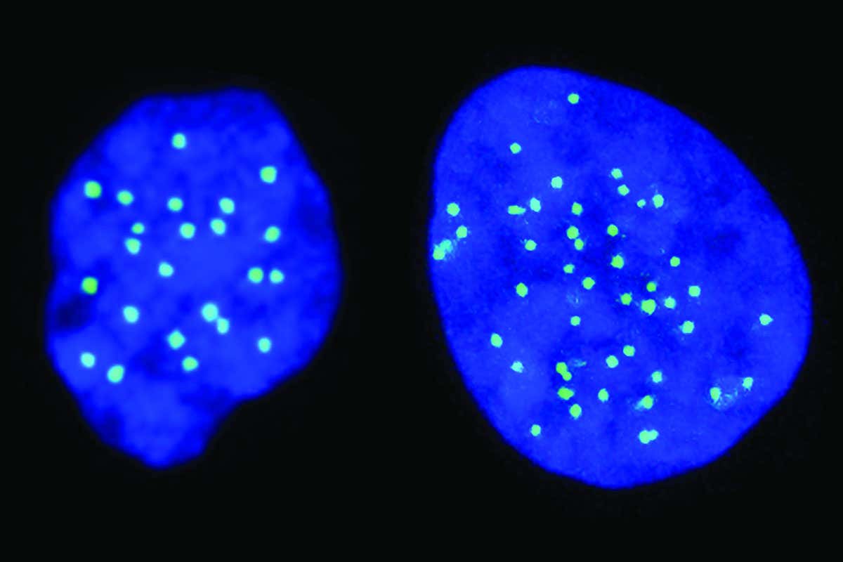 A haploid cell with 23 chromosomes (left), and a diploid cell with 46 chromosomes (right).