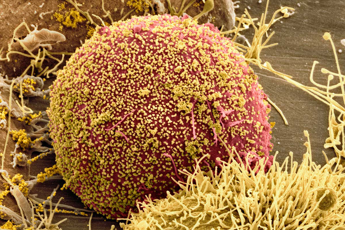 Cell infected with HIV. Coloured scanning electron micrograph (SEM) of HIV particles (yellow) budding from the membrane of a host cell (red).