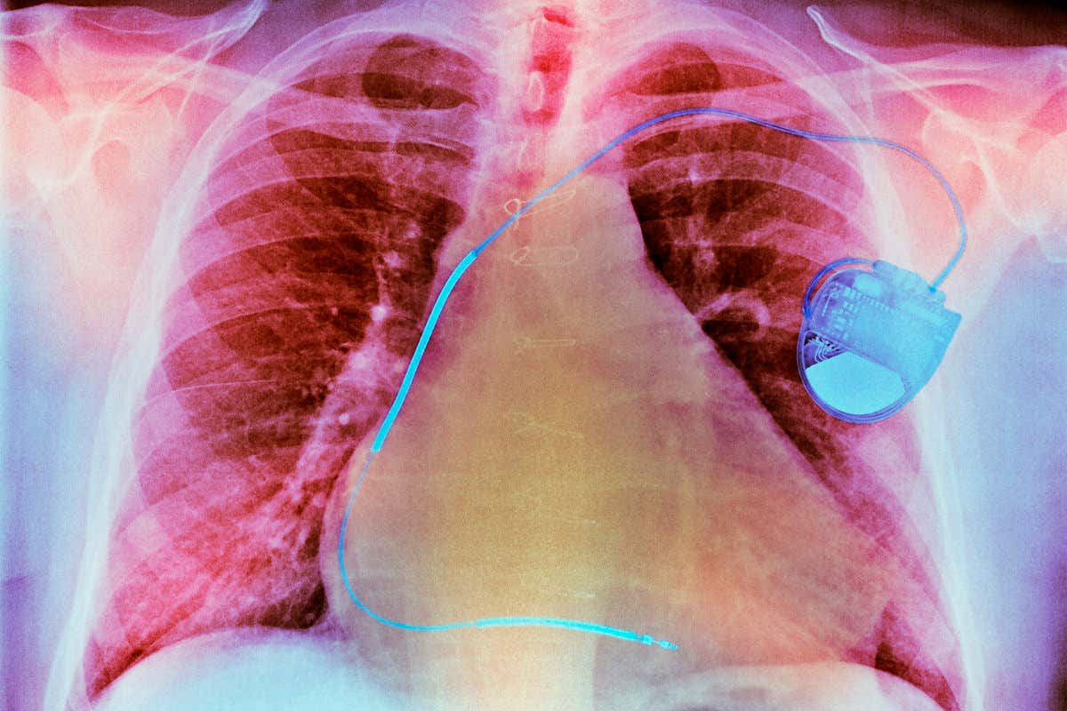 Wireless signal sent through meat fast enough to watch Netflix