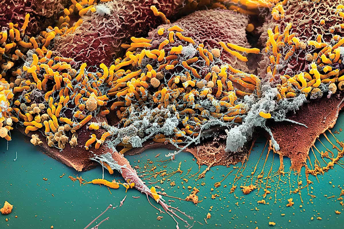 Microscope image of helicobacter bacteria