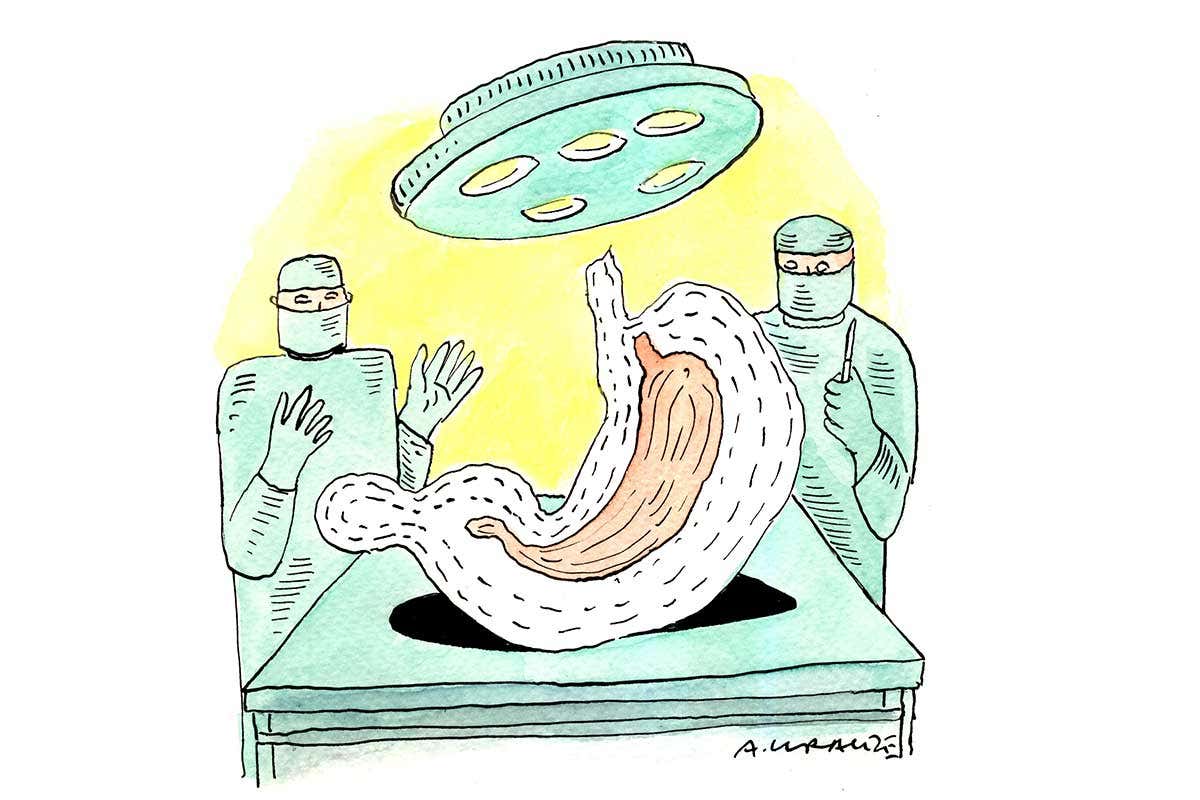 Cartoon shows surgeons operating what appears to be a giant stomach