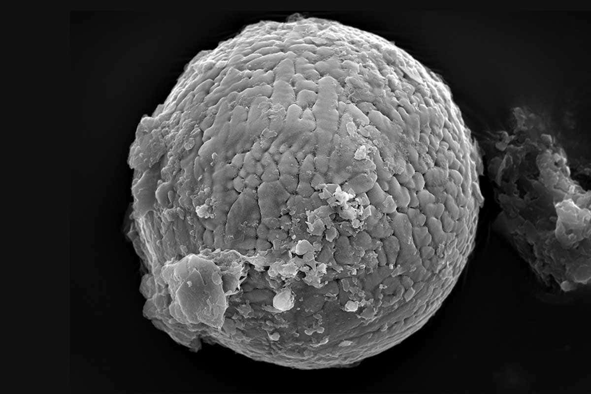 round, grey blob on micrograph