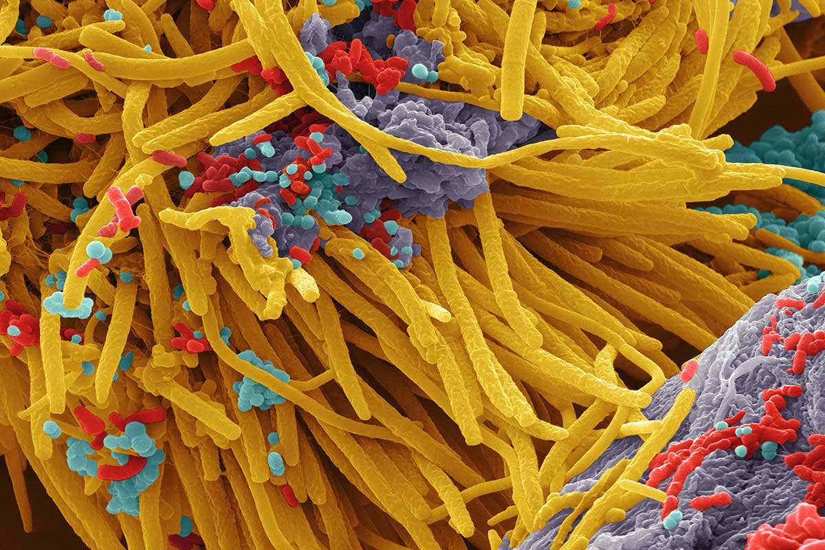 Oral bacteria. Coloured scanning electron micrograph (SEM) of mixed oral bacteria