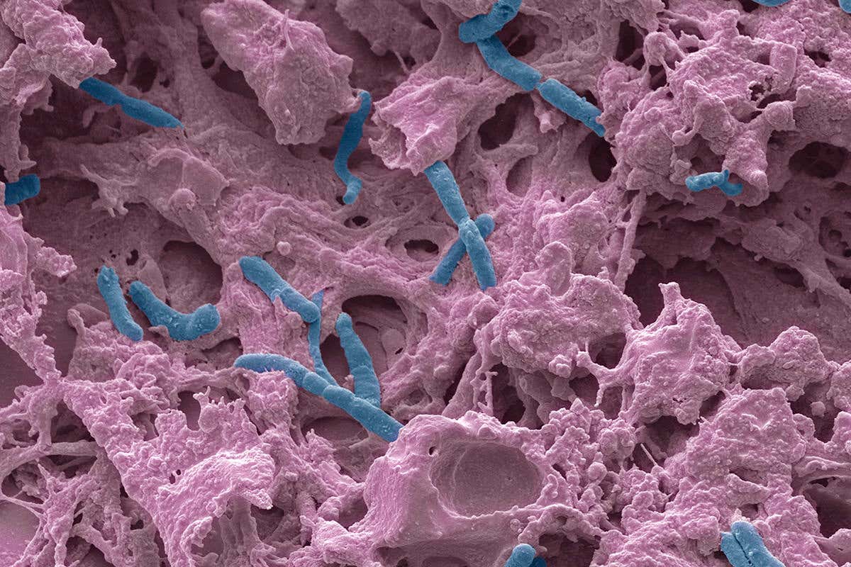 Pseudomonas aeruginosa under the electron microscope