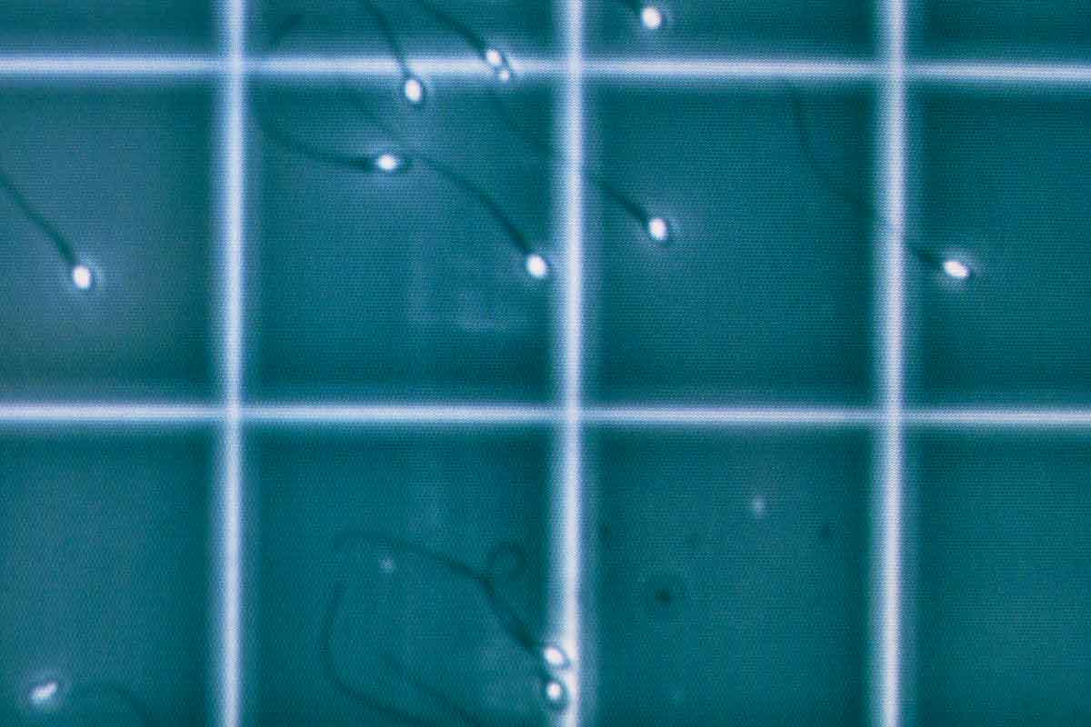 Sperm cells with a grid superimposed