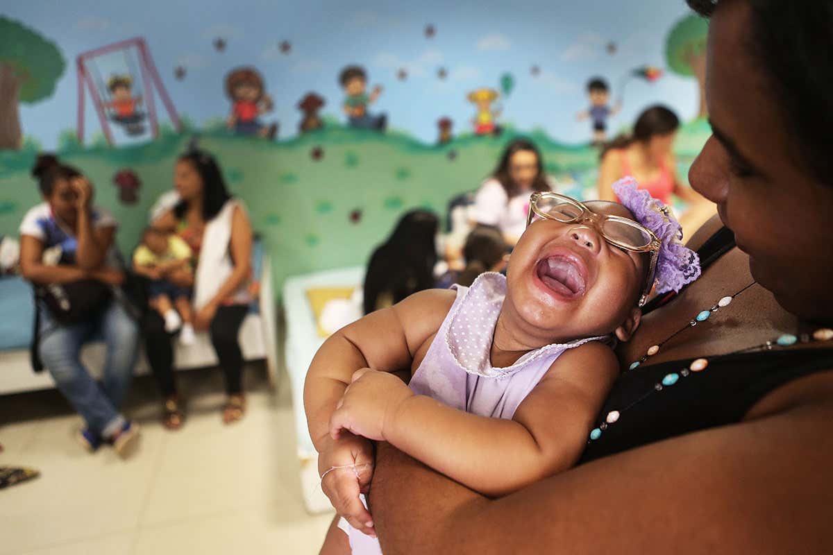 An infant with microcephaly caused by zika infection