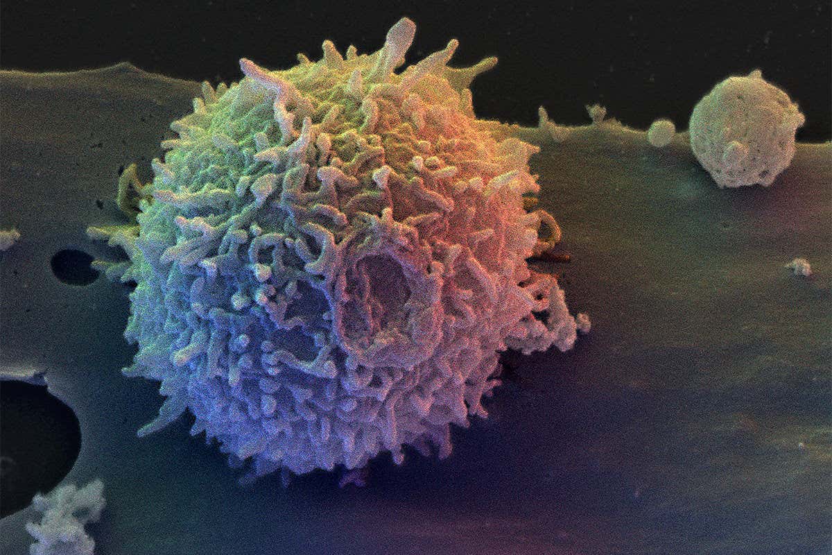 A lymphocyte seen through an electron microscope