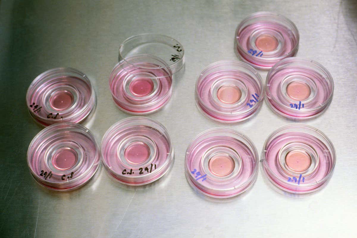 Petri dishes containing unfertilised human eggs