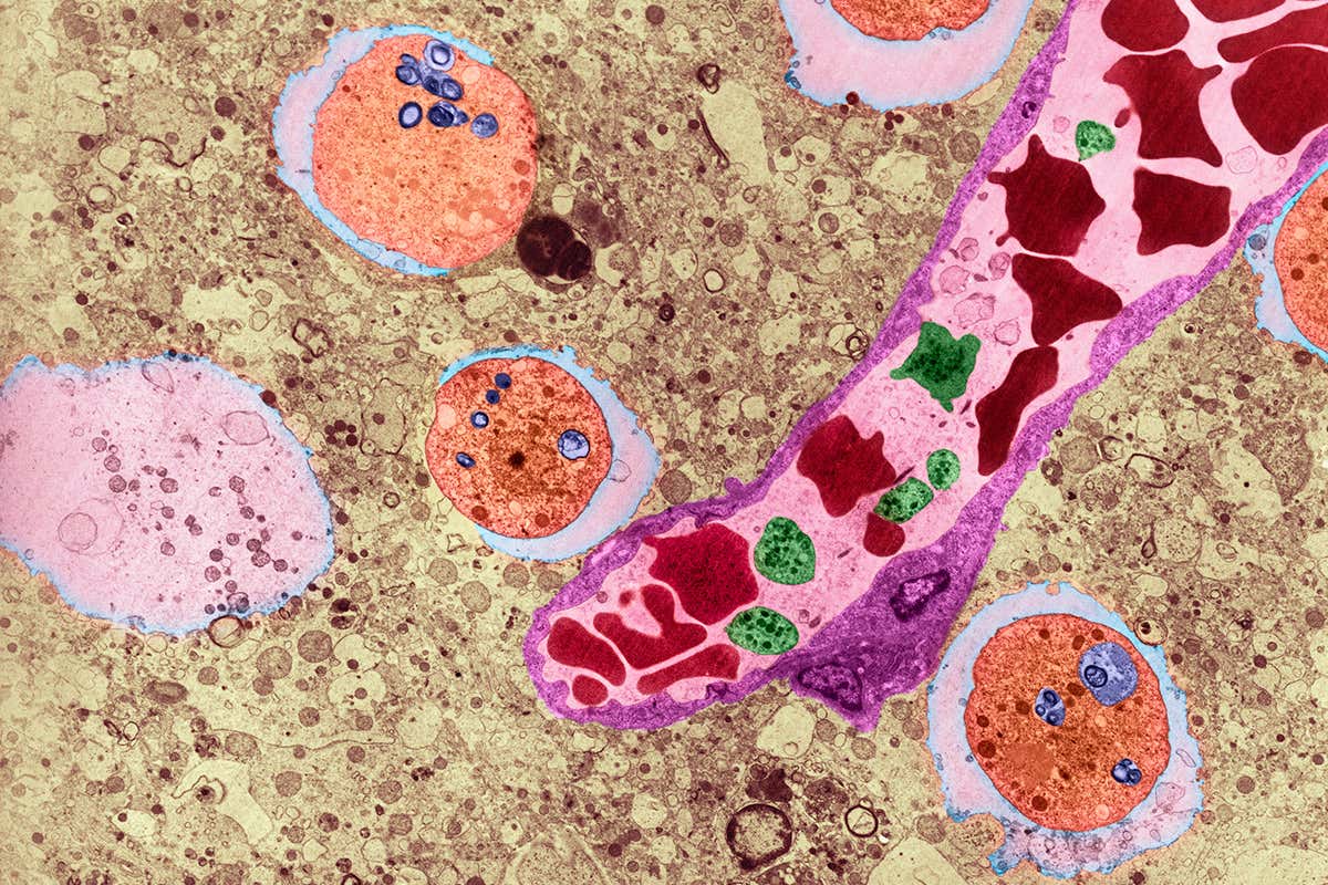 Electron micrograph showing amoebas in orange