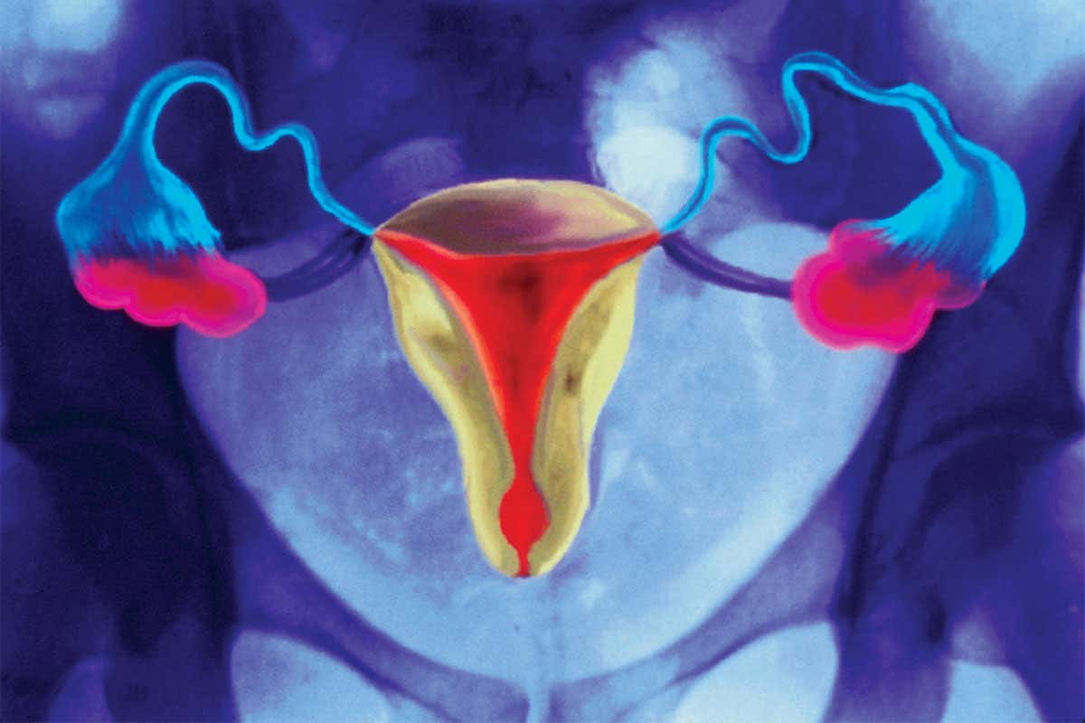 Female reproductive organs seen on an X-ray