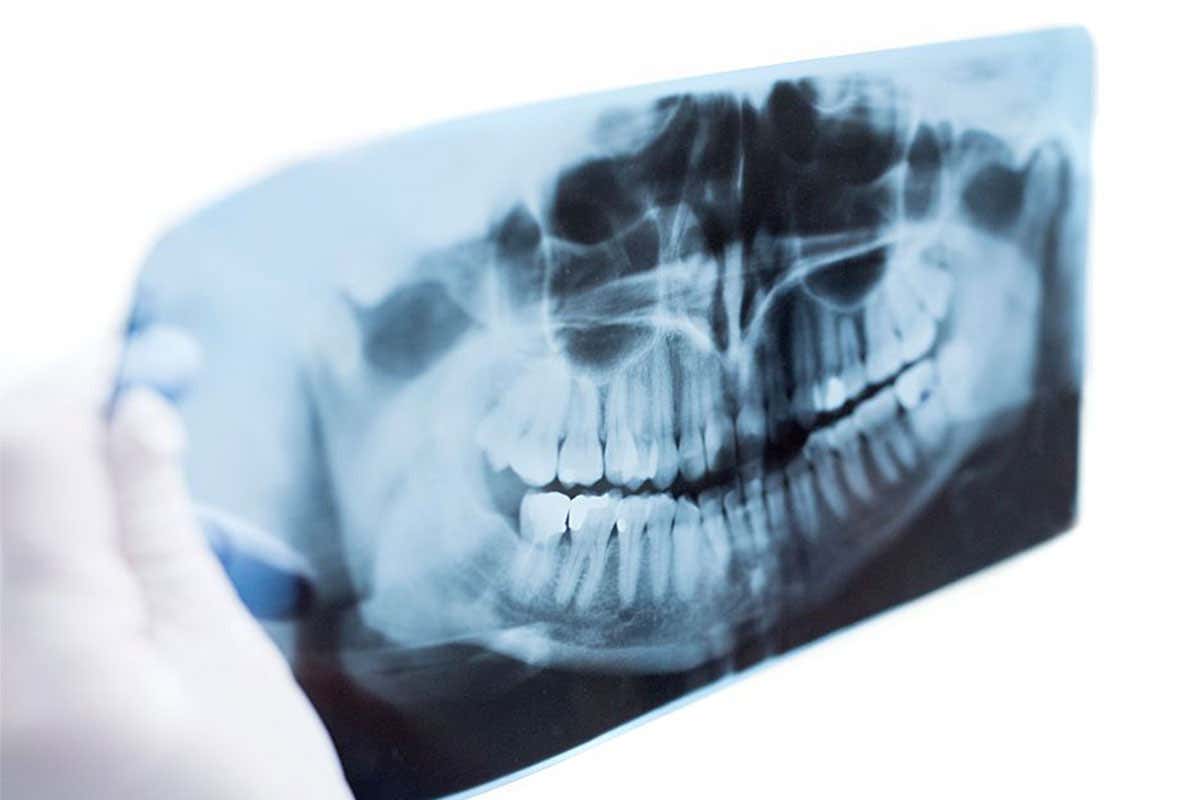 picture of a dental scan